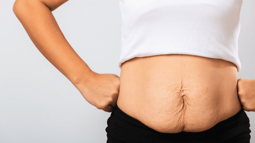 Rediscover Your Pre-Pregnancy Body with a Mommy Makeover
